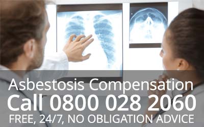 Types and Stages of Asbestosis